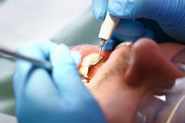 Best Urgent Tooth Repair  in Monte Sereno, CA