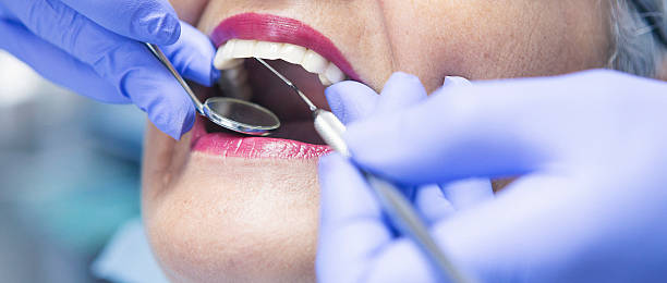 Best Urgent Tooth Repair  in Monte Sereno, CA